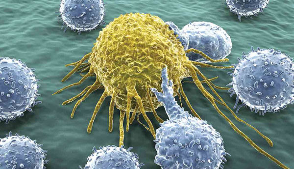 Krebstherapie mit Ozon: T-Lymphozyten attackieren Krebszelle